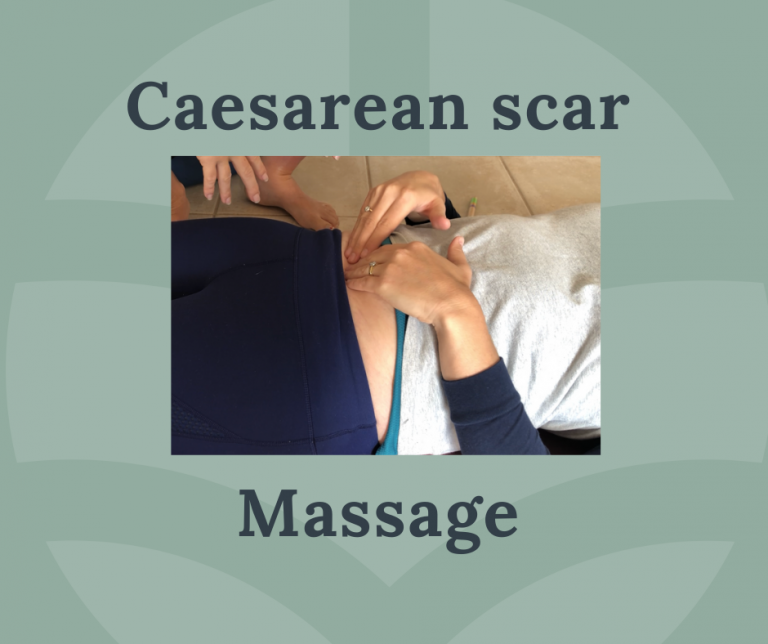 Caesarean Scar Massage