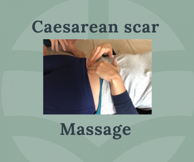 Caesarean Scar Massage